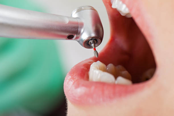 Best Mobile Emergency Dentist in Beaufort, SC